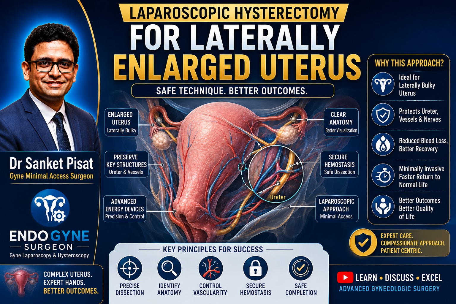 Lap Hysterectomy Laterally Enlarged Uterus (TLH) (SS0002)