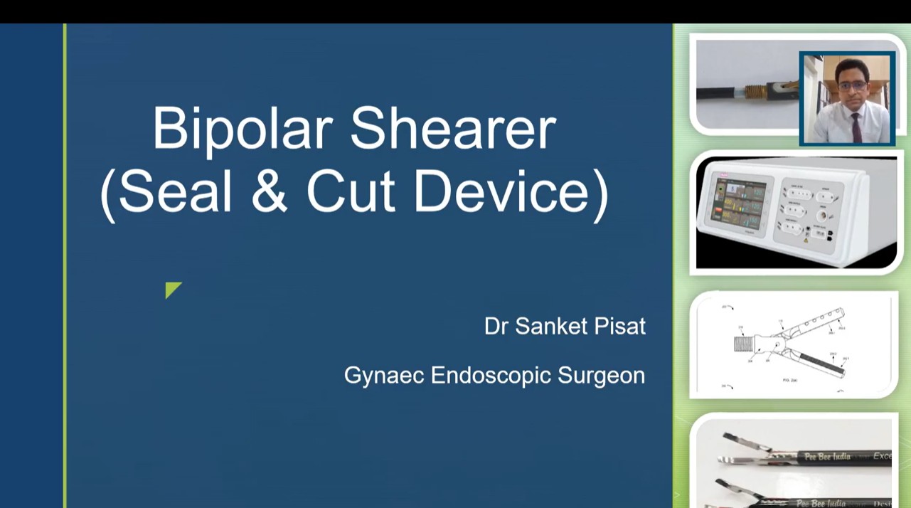 Bipolar Shearer