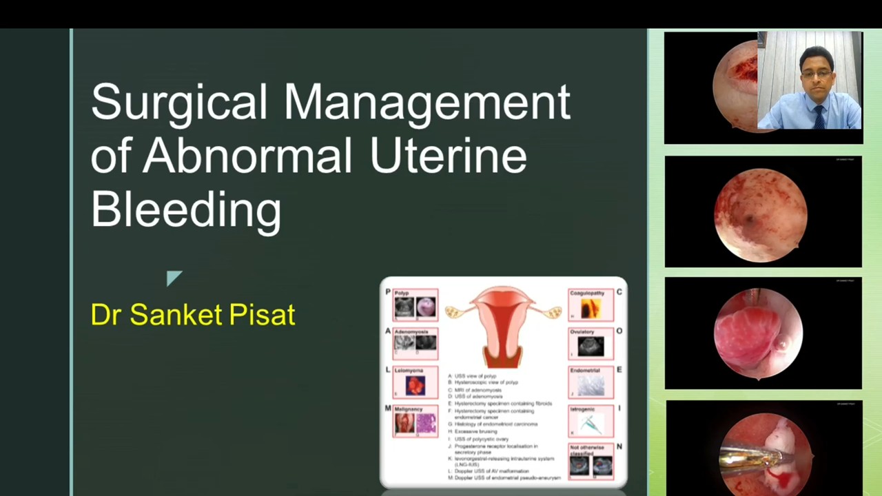 CL01 Surgical Management Of Abnormal Uterine Bleeding