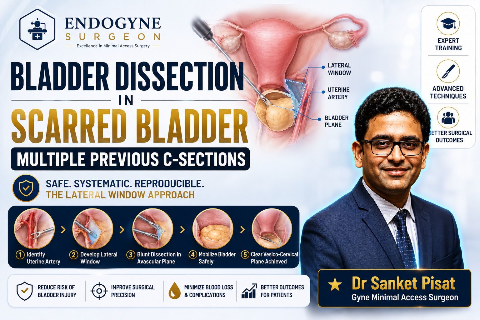 Laparoscopic Bladder Dissection for Scarred Bladder (TLH) (SS0004)