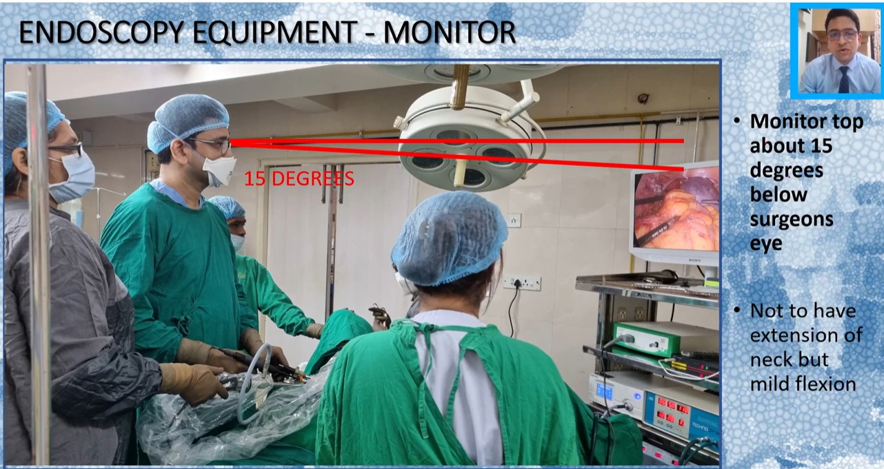 Ergonomics in Laparoscopy